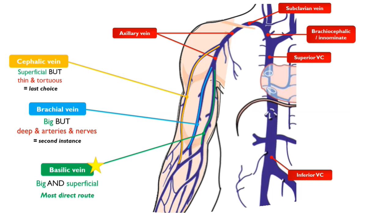 Different PICC insertion routes (amongst which the right basilic vein is the most preferred)
